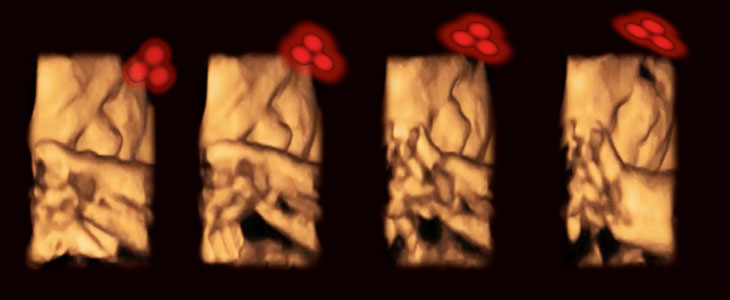 4-D ultrasound and triangle dots