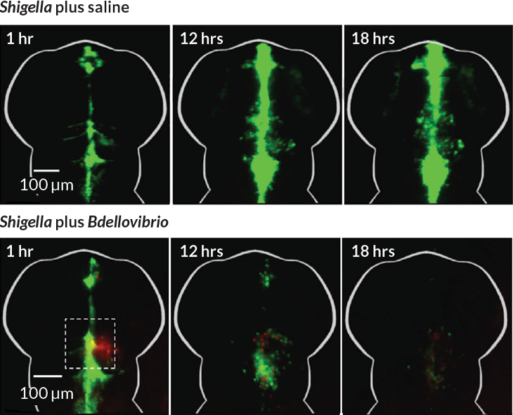 zebrafish brain versus Shigella