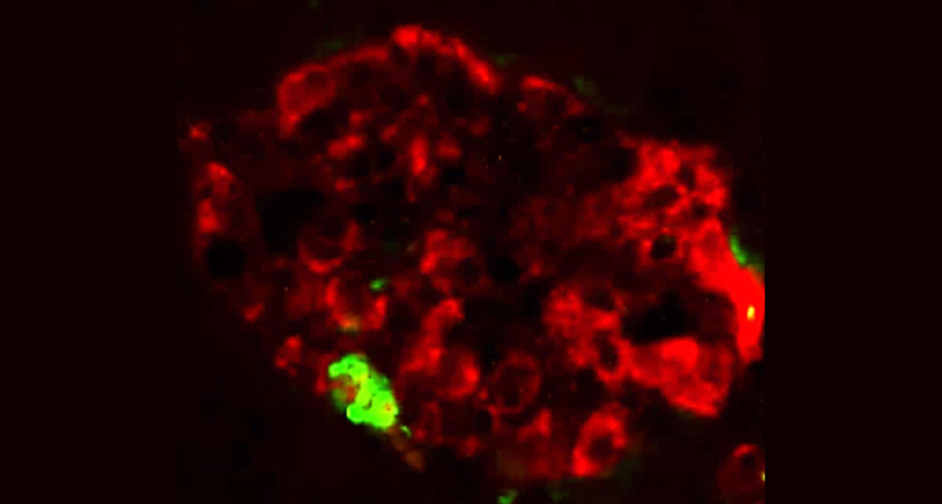 deformed mouse pancreas proteins