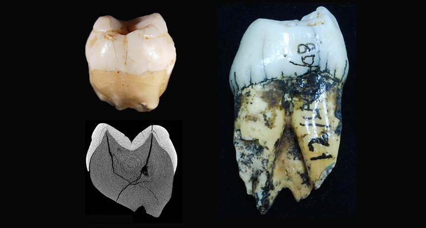 human teeth from Sumatran cave