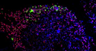 Zika virus and stem cells