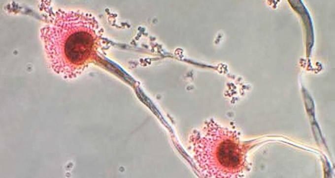a common fungus, Aspergillus fumigatus