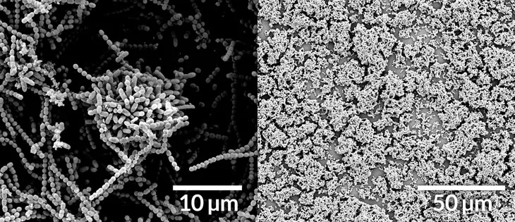 magnified images of Strep bacteria