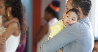 baby with microcephaly