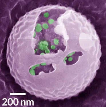 an artificial beta cell