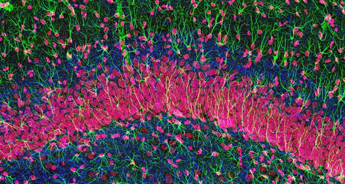 hippocampal nerve cells