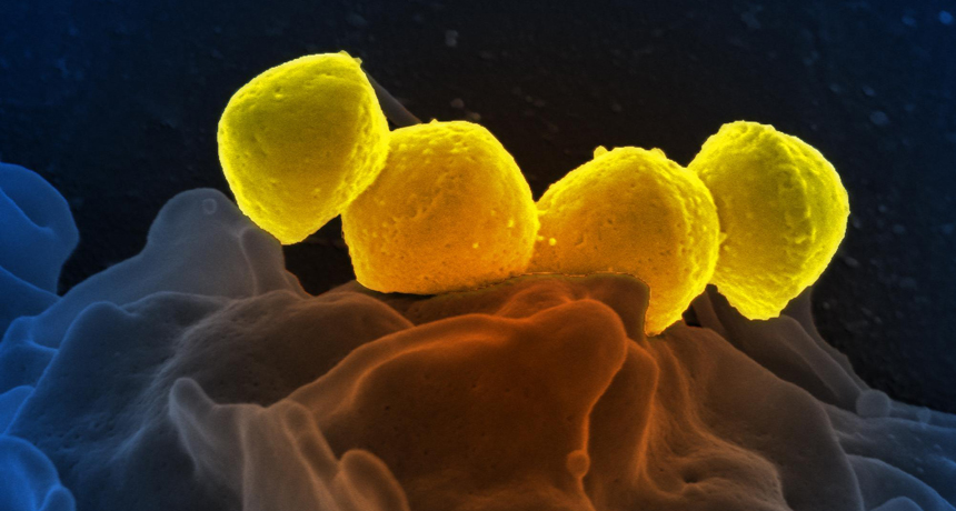 Streptococcus pyogenes