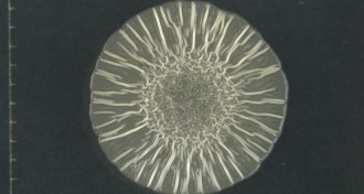 E. coli colony