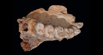 partial jaw bone