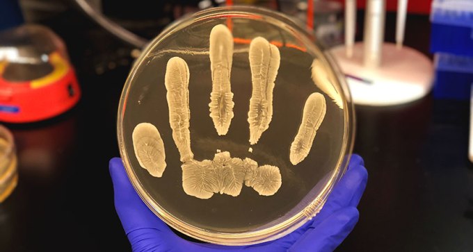 Staphylococcus epidermidis petri dish
