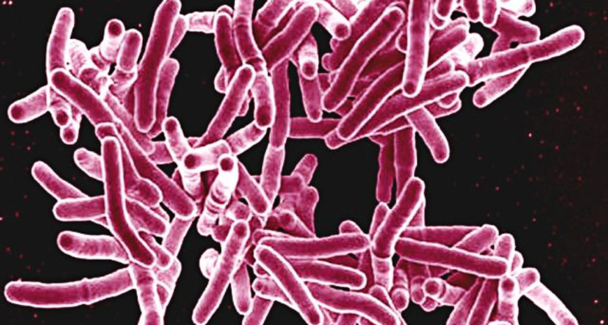 tuberculosis bacteria
