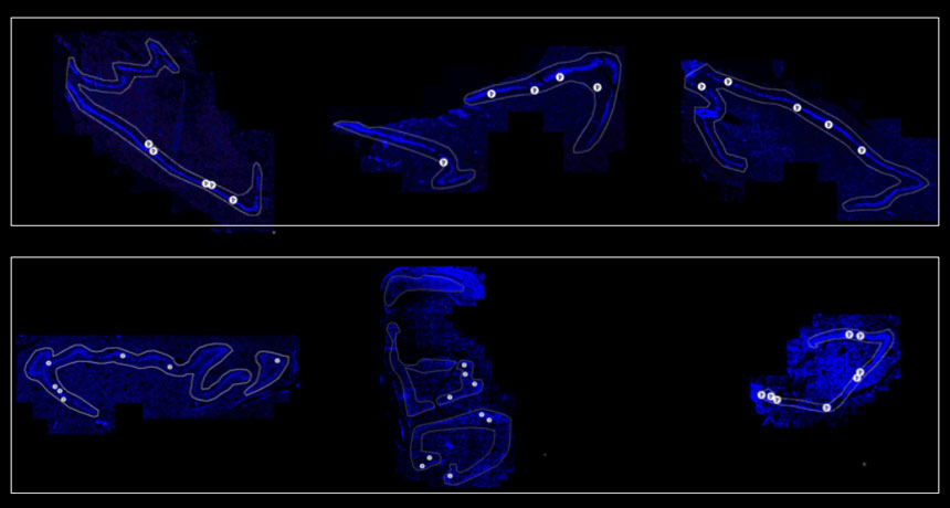 nerve cells in hippocampi