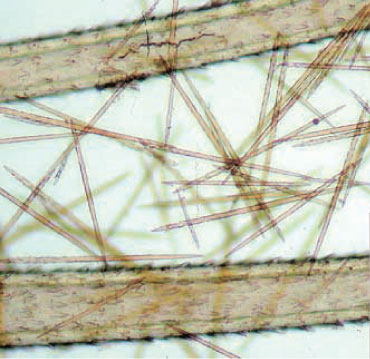 mangnified image of theoak processionary caterpillar’s detachable setae