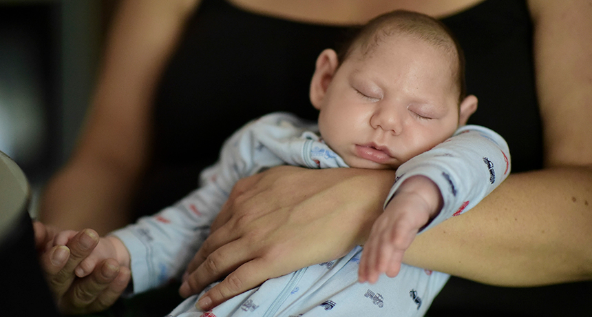 baby with Zika-related microcephaly