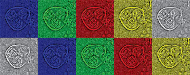 electron micrograph image showing viruses packaged in a vesicle