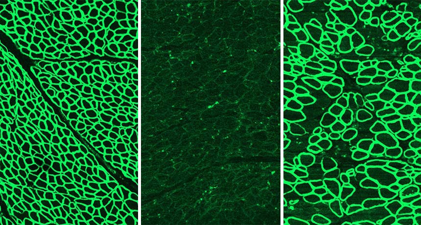 an image of the muscle protein dystrophin