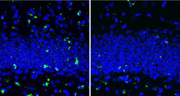 two images of the brains of 8-month-old mice
