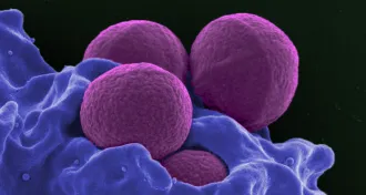 Staphylococcus aureus bacteria