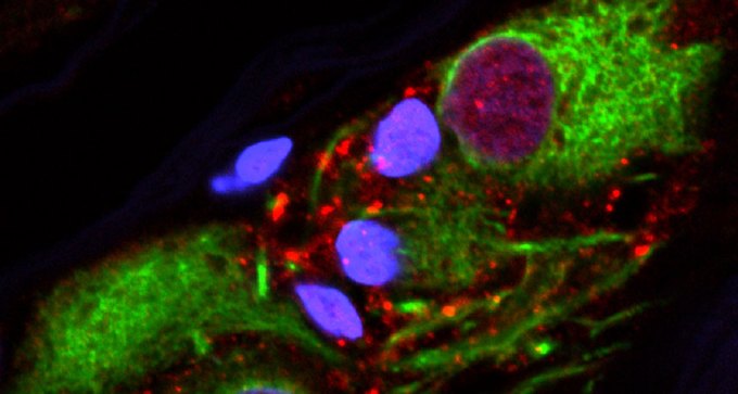 globs of alpha-synuclein protein