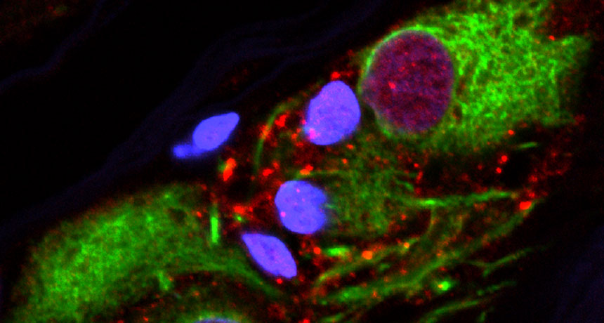 globs of alpha-synuclein protein