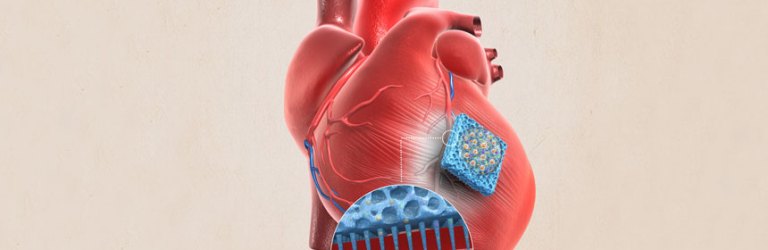 illustration of microneedle patch