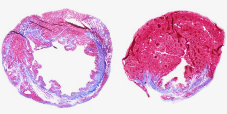 a photo of heart tissue samples