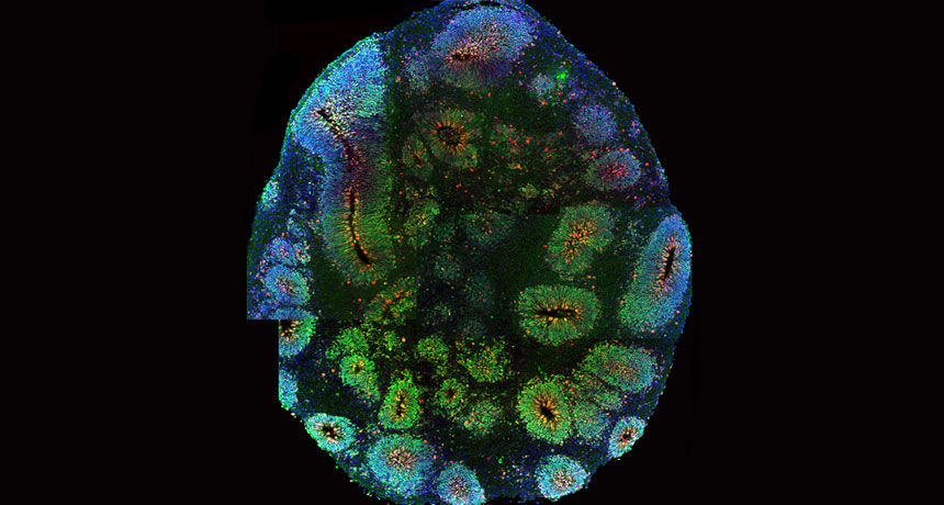 Lab-grown brain organoids