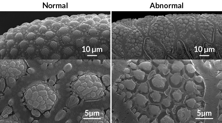 scanning electron micrograph images of the shells of Aedes aegypti eggs