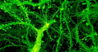 nerve cells
