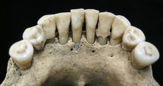 jaw of medieval woman