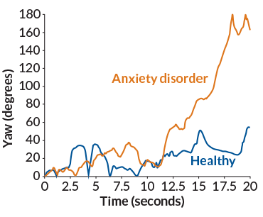 a graph showing how children with an anxiety disorder reacted differently to a percieved threat