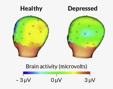 brain activity in healthy and depressed kids