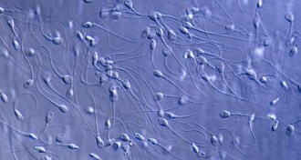 sperm