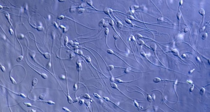 sperm