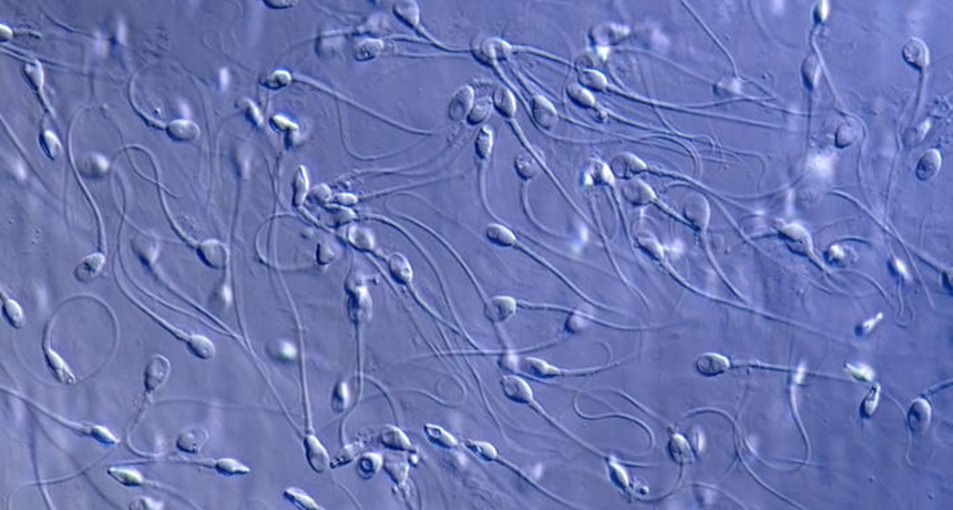 sperm