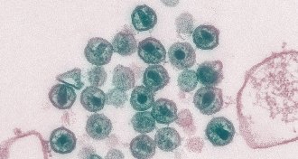 HIV virions