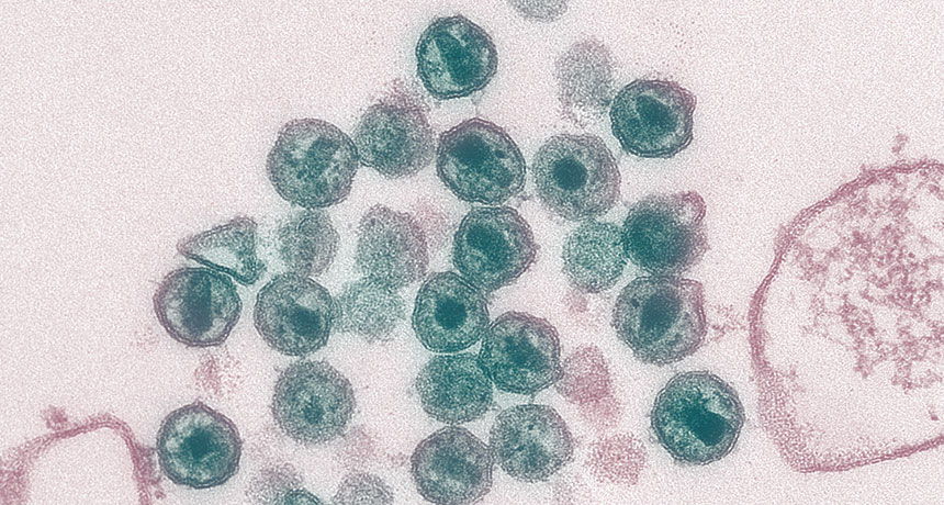 HIV virions
