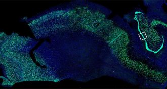 hippocampus microscopy