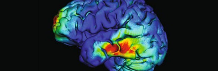 brain scan