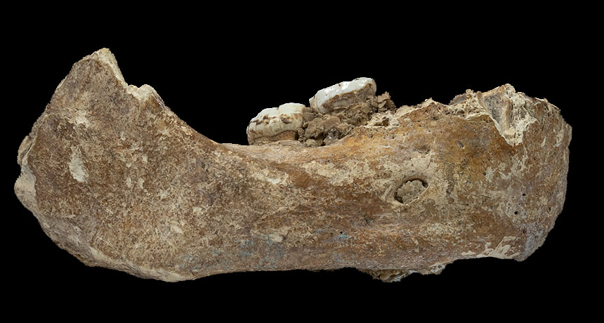 jaw bone