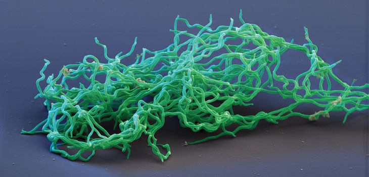 Borrelia burgdorferi