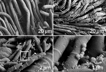 scanning electron microscopy