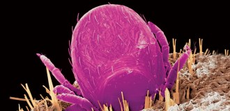 tick attached to skin