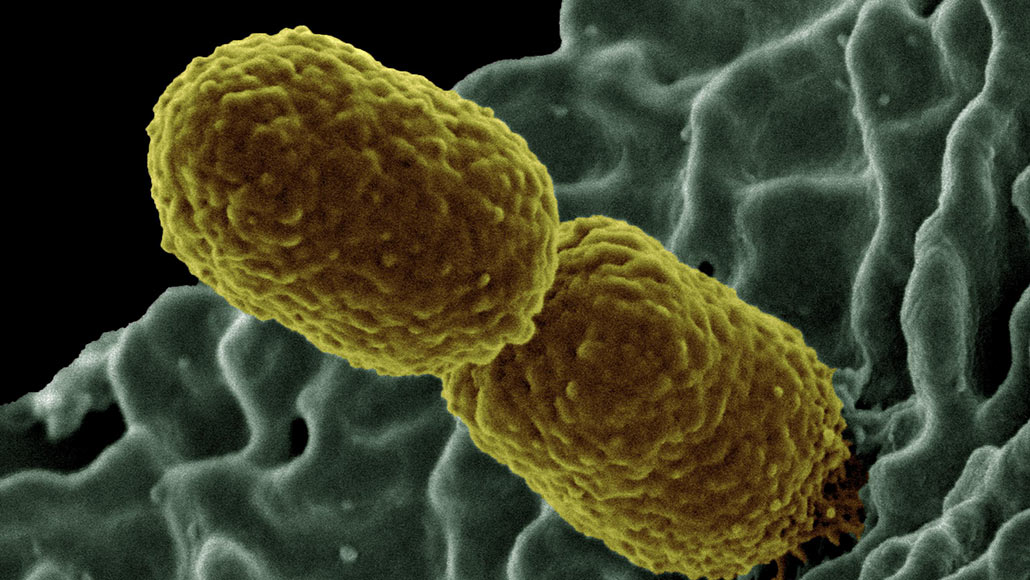 Klebsiella pneumoniae