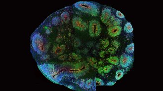 organoid