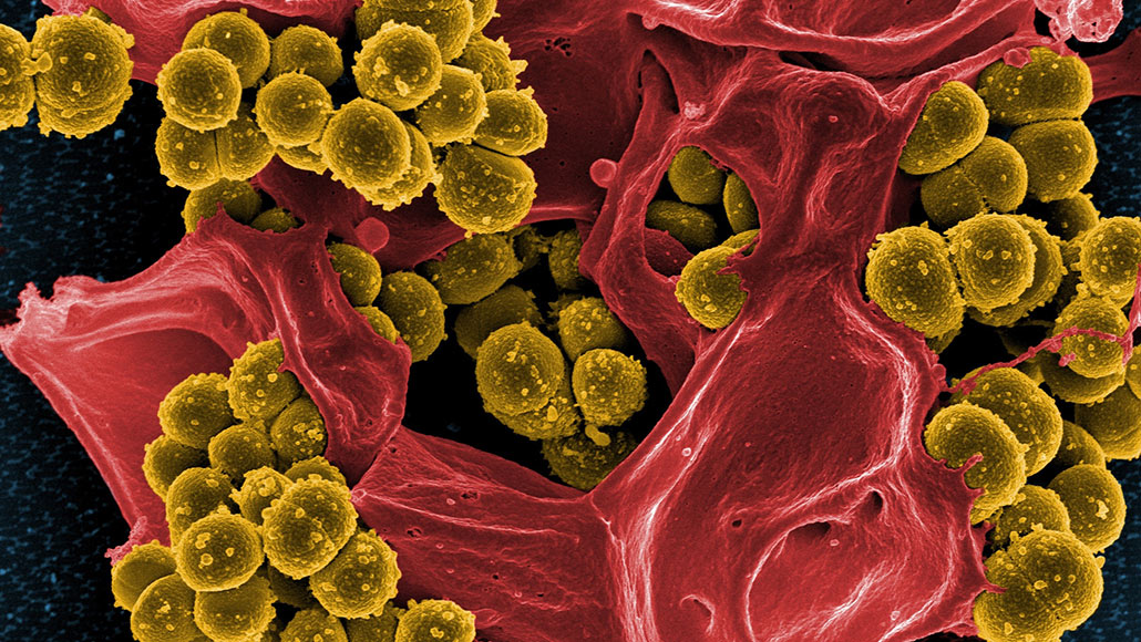 MRSA bacteria
