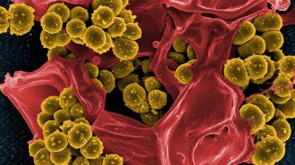 MRSA bacteria