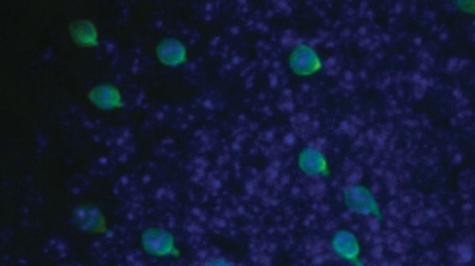 Brush cells in the lining of a mouse’s olfactory bulb