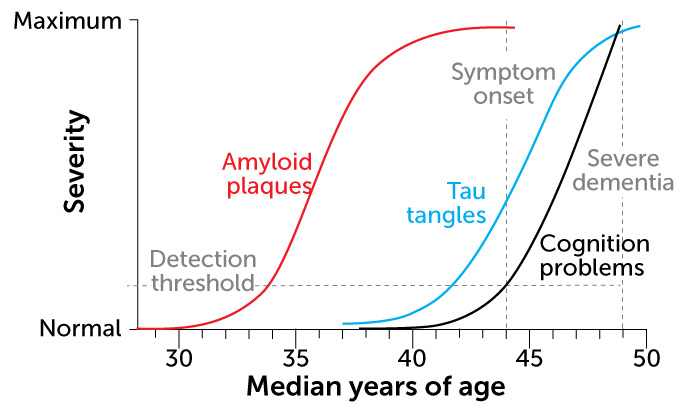 Early onset Alzheimer’s progression