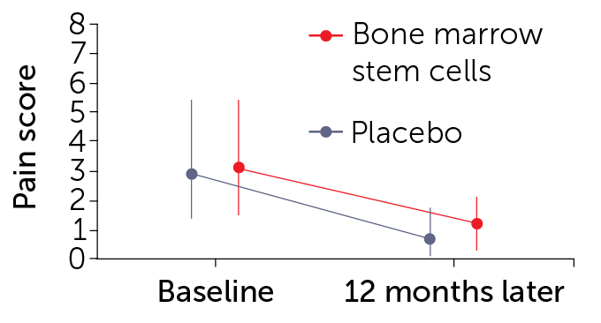 Pain in knee osteoarthritis
